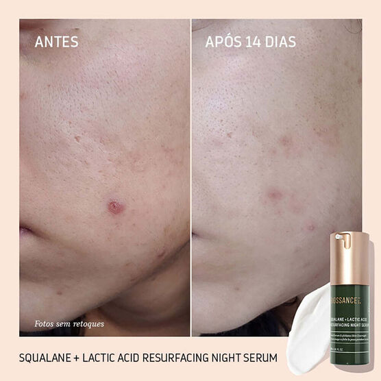 BIOSSANCE  LACTID ACID   SERU 30ML